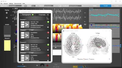 Tomographic feedback module for BEE Lab software